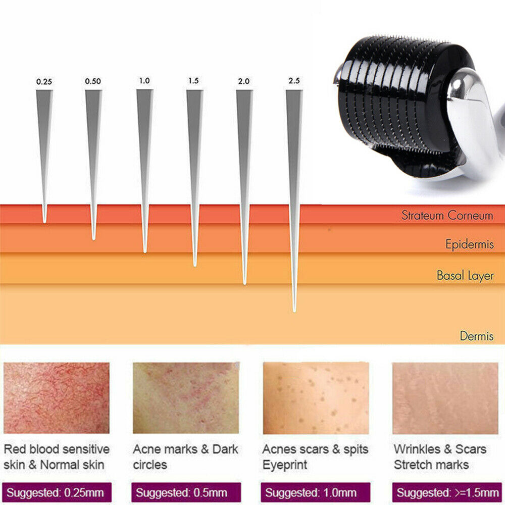 (540 aghi) Rullo in titanio Derma Micro Needle per la perdita dei capelli da acne